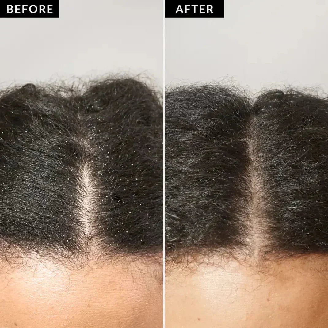 ClearScalp™ Detox Comb (80% OFF TODAY ONLY)